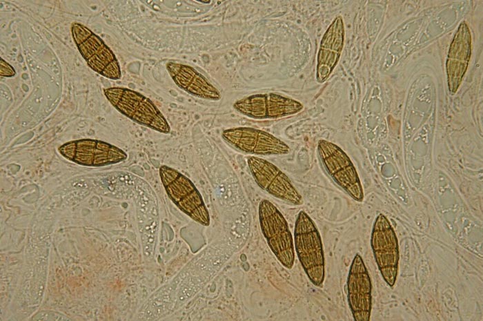 macrostoma