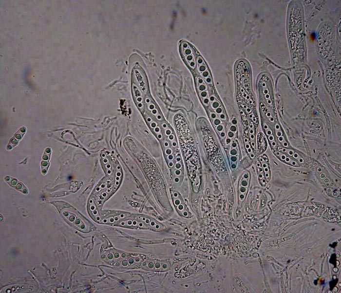 macrostoma
