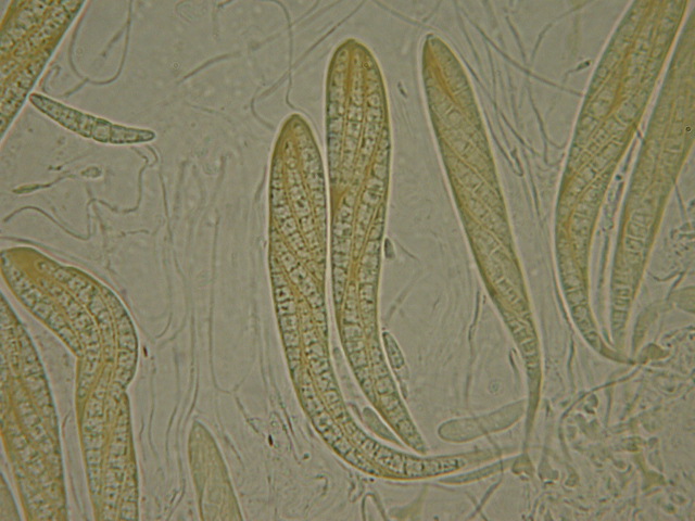 macrostoma