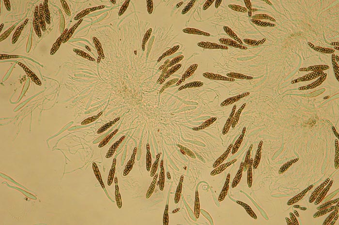 macrostoma