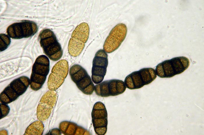 macrostoma