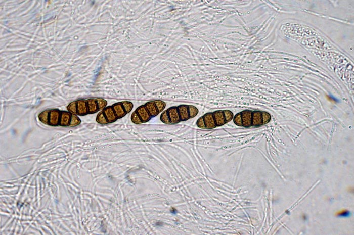 macrostoma