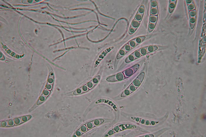 macrostoma