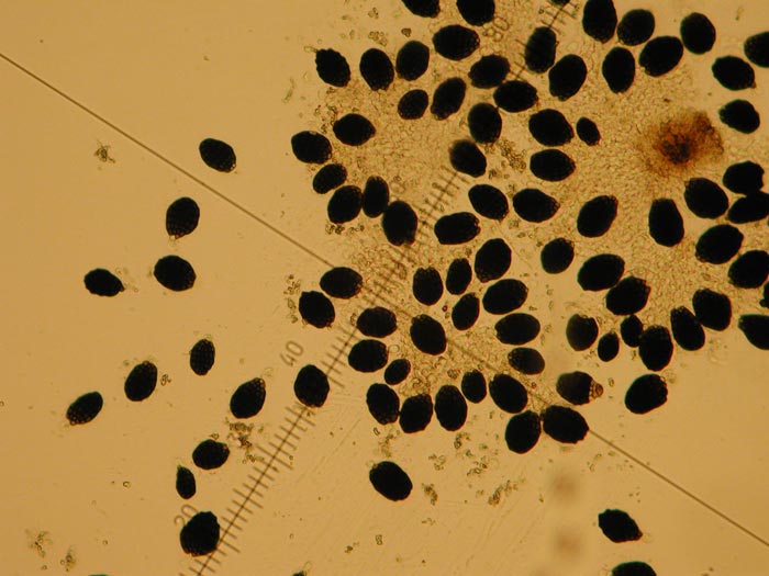 macrostoma