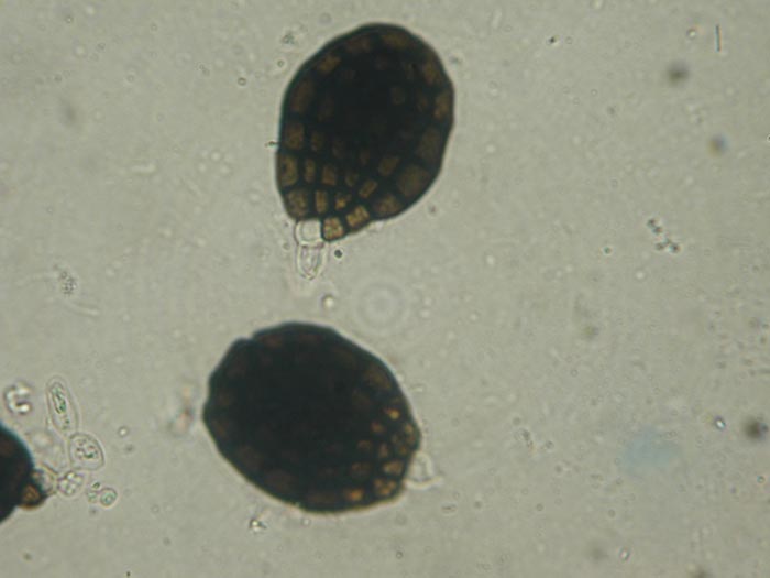 macrostoma