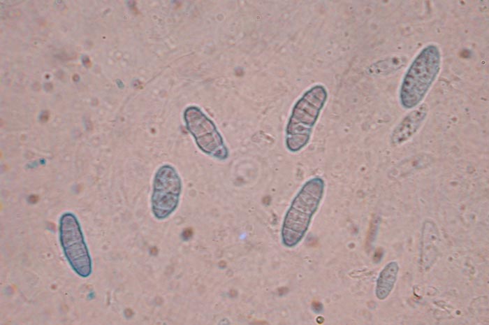 macrostoma