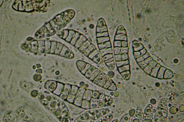 macrostoma