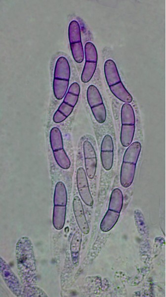 macrostoma