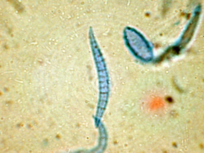 macrostoma
