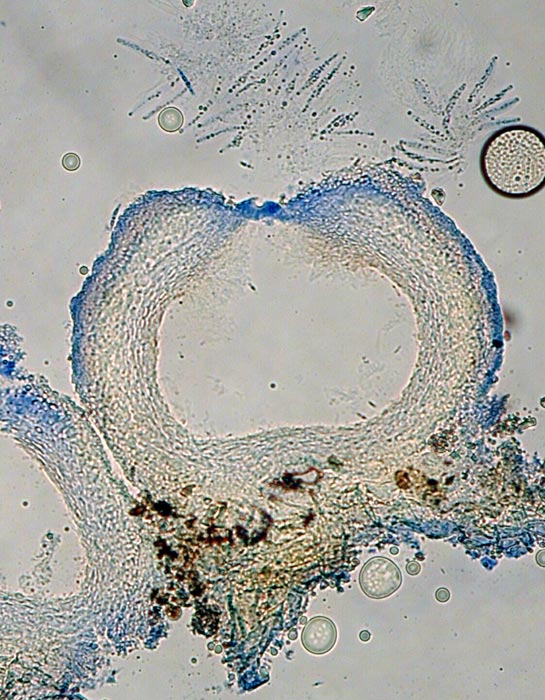 macrostoma