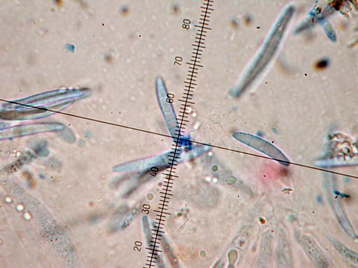 macrostoma