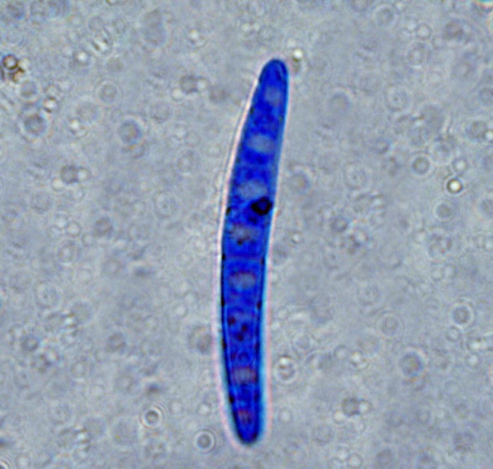 macrostoma