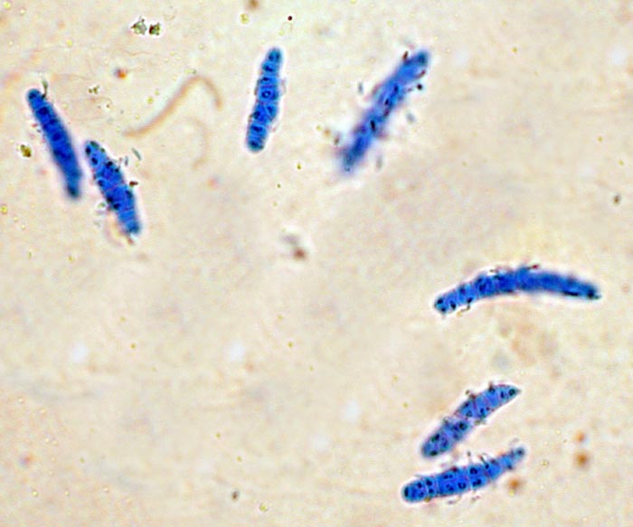 macrostoma