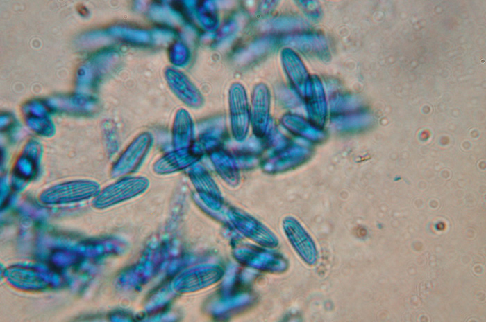 macrostoma