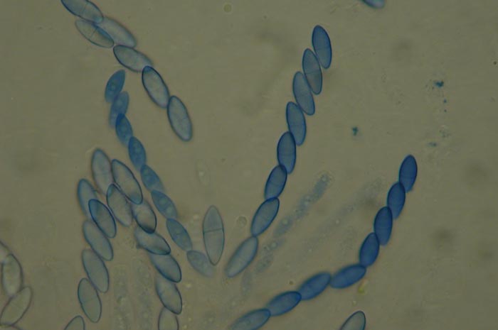 macrostoma
