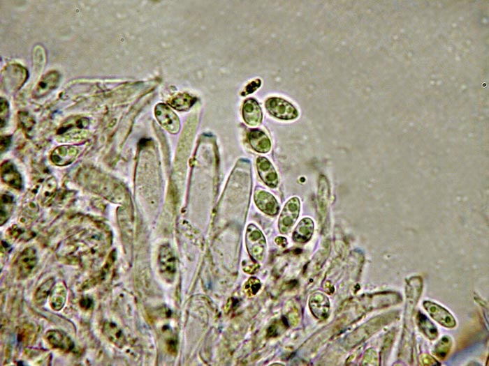 macrostoma