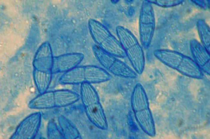 macrostoma