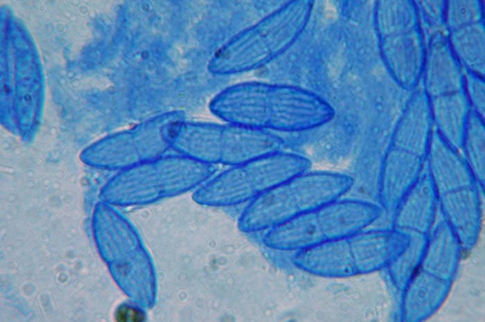macrostoma