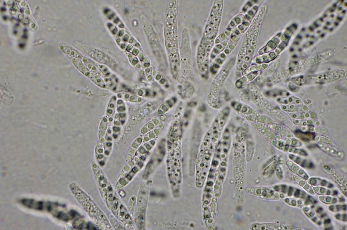 macrostoma