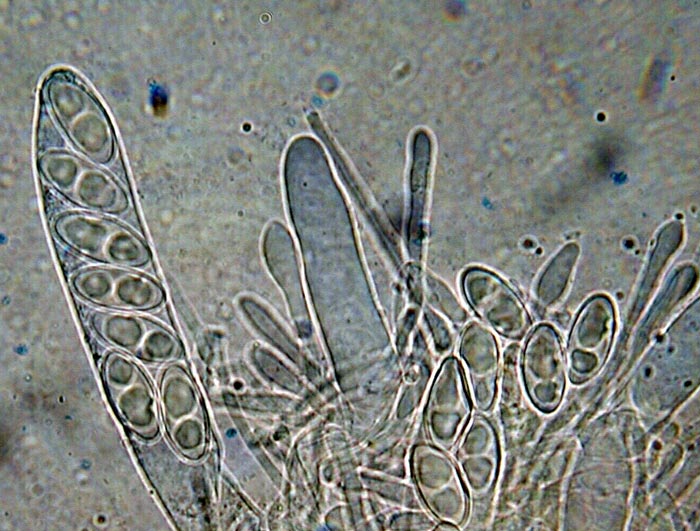 macrostoma