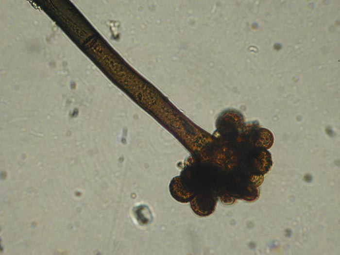 macrostoma