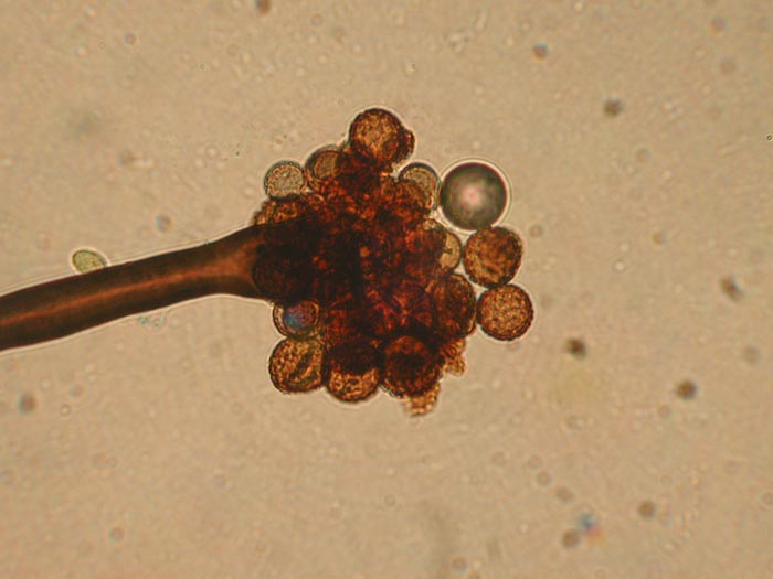 macrostoma