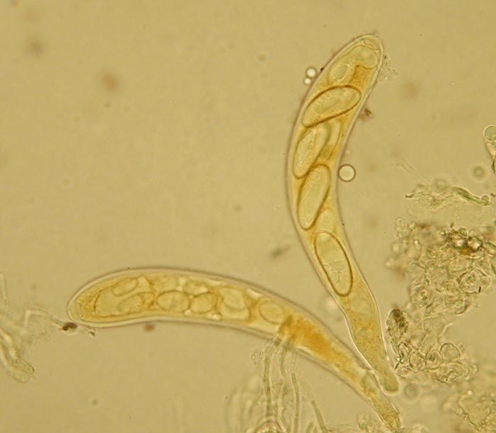 macrostoma