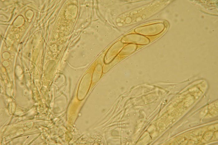 macrostoma