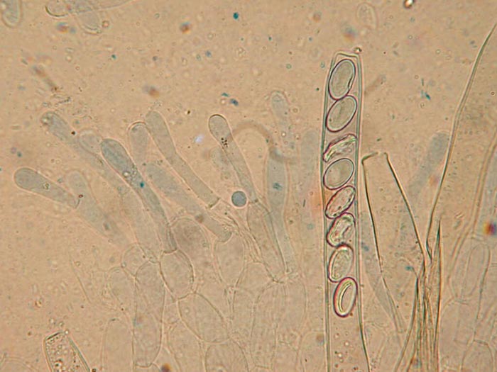 macrostoma
