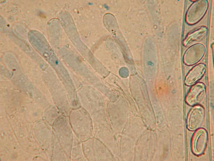 macrostoma