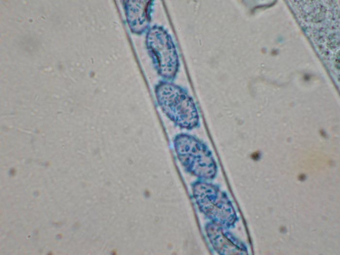 macrostoma