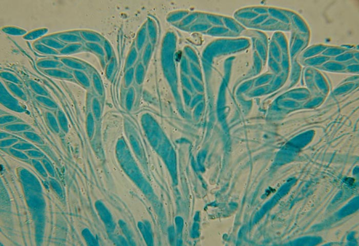 macrostoma