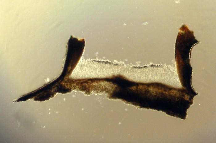 macrostoma