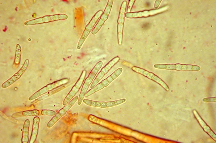 macrostoma