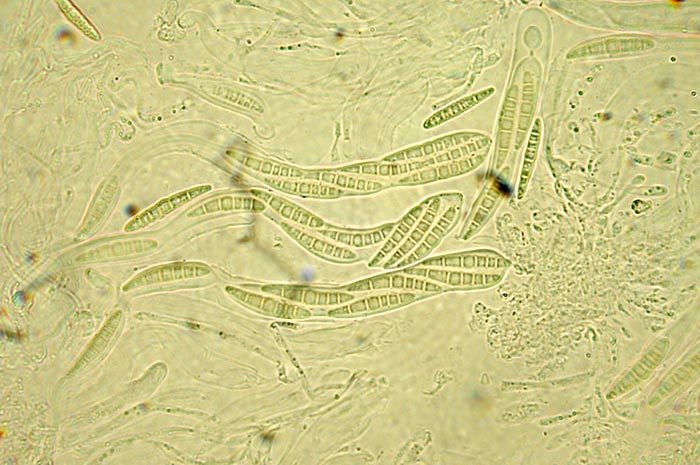 macrostoma