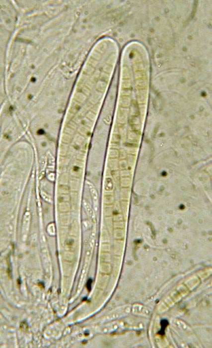 macrostoma