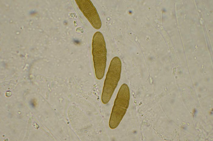 macrostoma