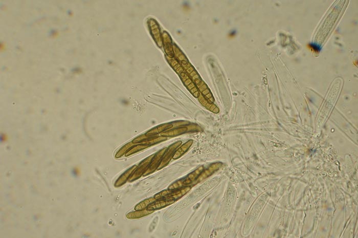 macrostoma
