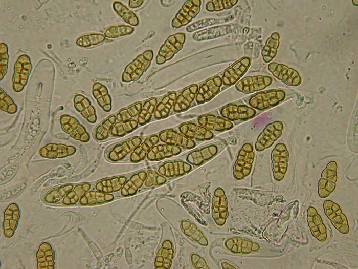 macrostoma
