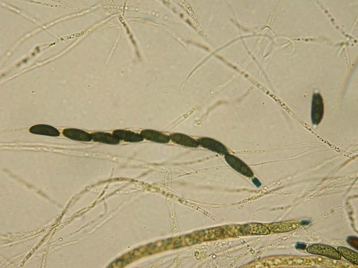 macrostoma