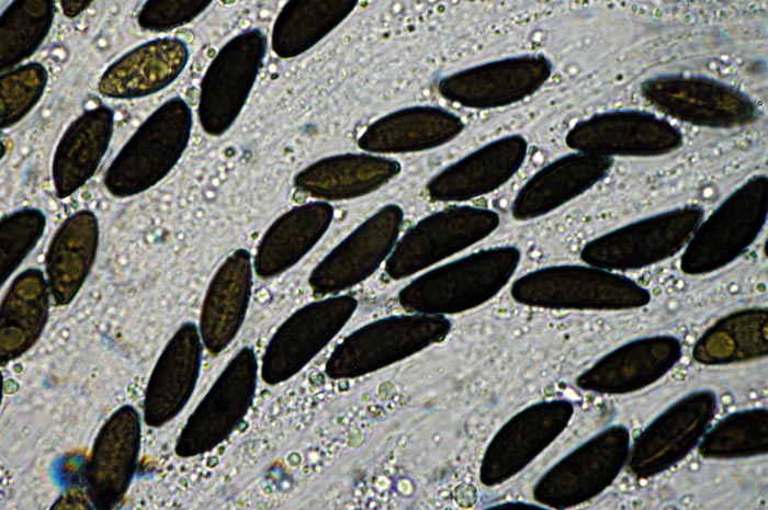 macrostoma