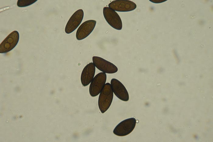 macrostoma