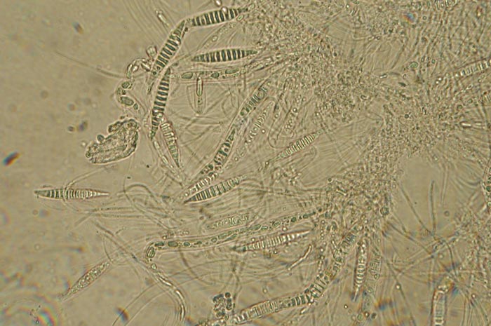 macrostoma