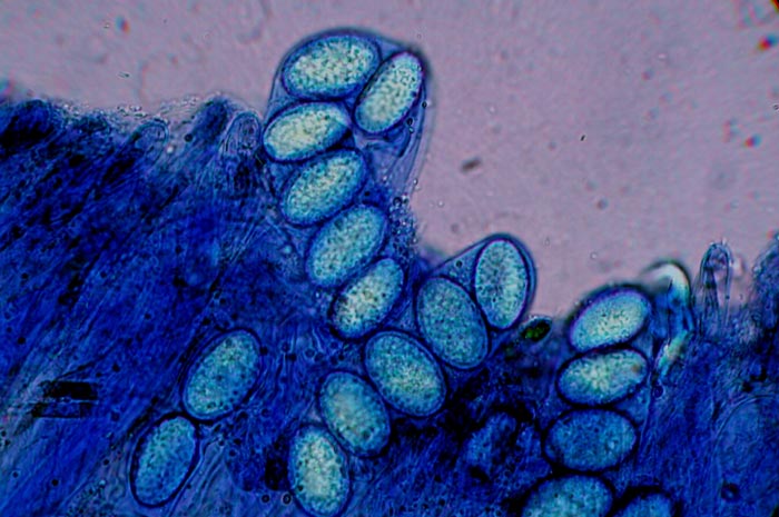 macrostoma