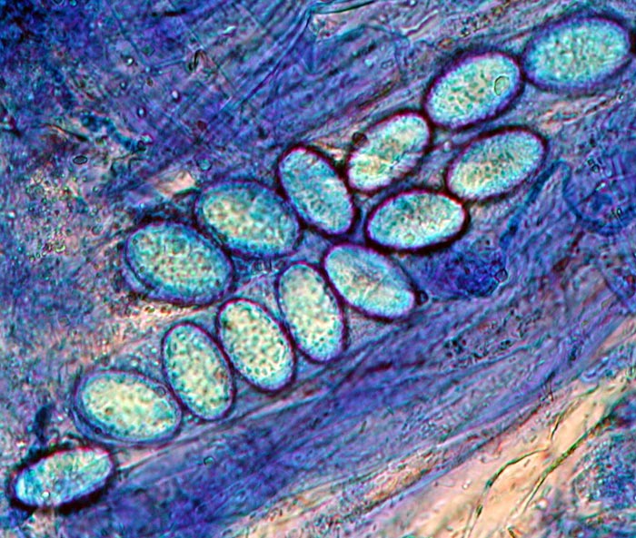 macrostoma