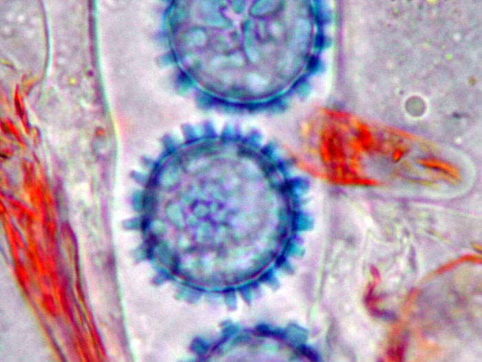 macrostoma