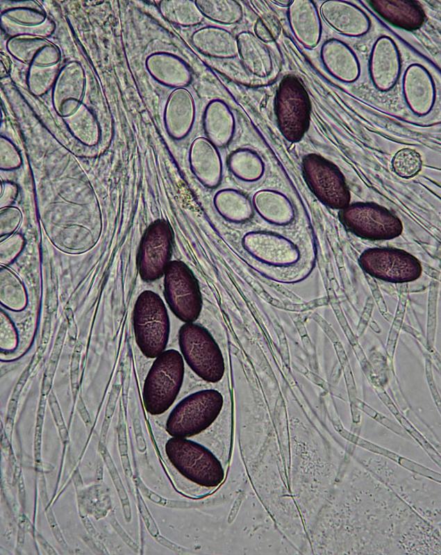 macrostoma