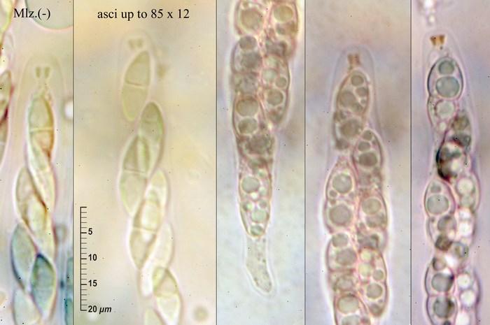 macrostoma
