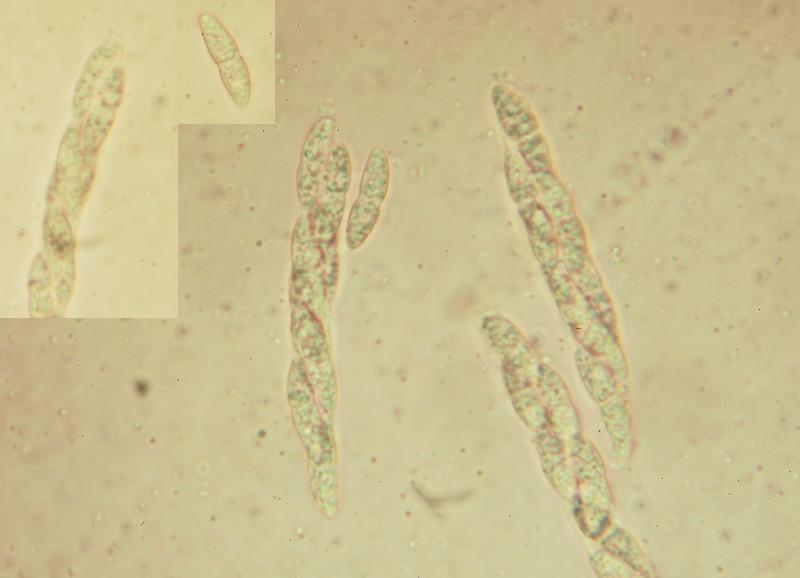 macrostoma