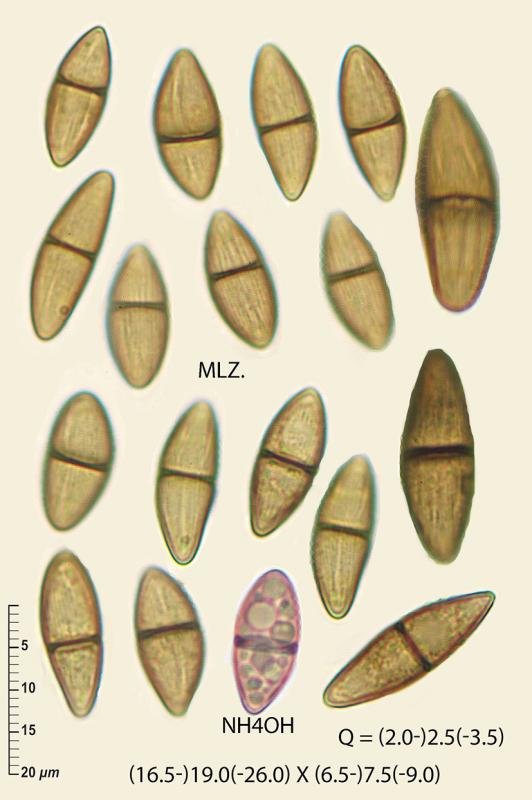 macrostoma